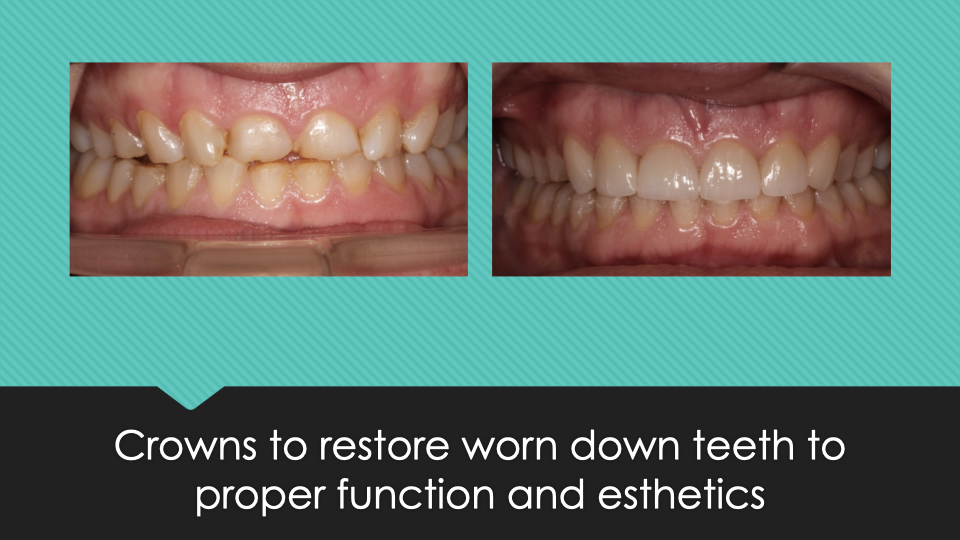 Patient Results at Village Smile Care