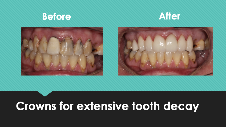 Patient Results at Village Smile Care