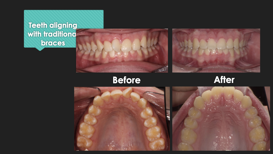 Patient Results at Village Smile Care