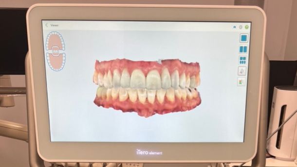 The Sound of a Smile: What Dentures Reveal About Modern Identity at Village Smile Care