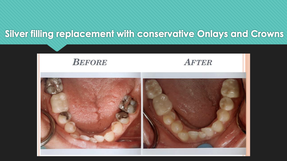 Patient Results at Village Smile Care