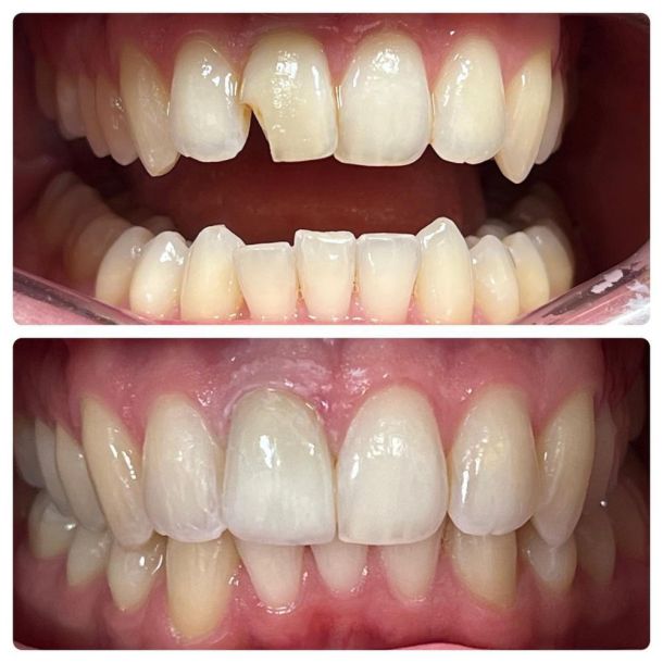 Common Myths and Misconceptions About Oral Surgery at Village Smile Care