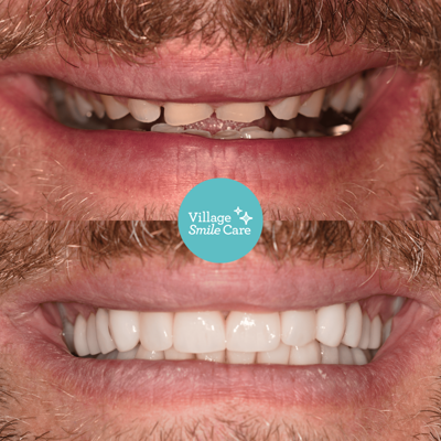 Village Smile Care banner photo