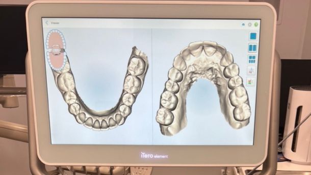 Inside a Modern Dental Clinic: What Technology is Revolutionizing Patient Care? at Village Smile Care