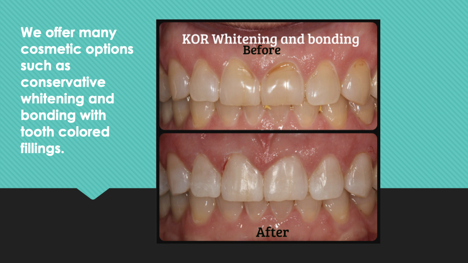 Patient Results at Village Smile Care