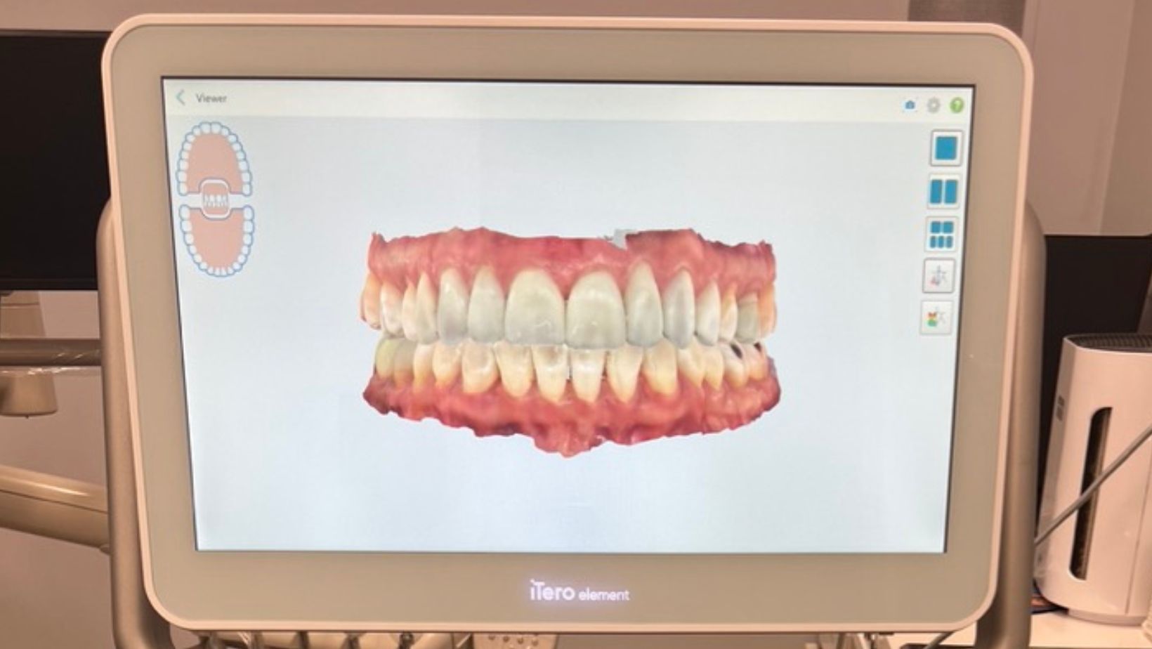 When Memories Bite Back: The Emotional Legacy of Losing Teeth and Choosing Dentures at Village Smile Care Village Smile Care banner photo