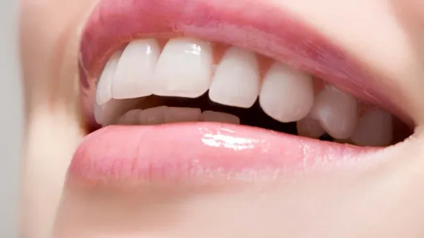 When to Consider Denture Relining or Refitting at Village Smile Care