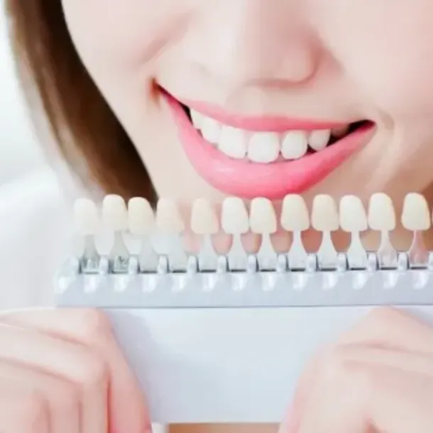 How Dental Veneers Can Mask Tooth Discoloration Effectively at Village Smile Care